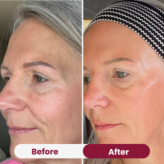 Bio-Collagen Glow Mask